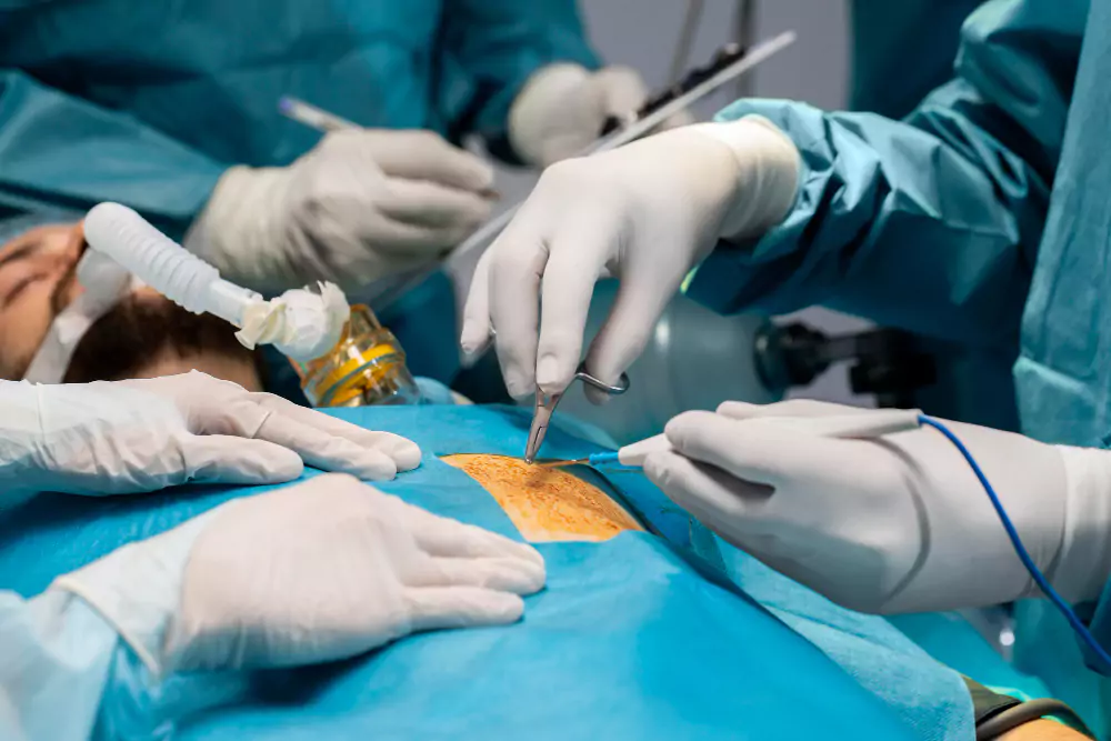 Hernia Repair Surgery